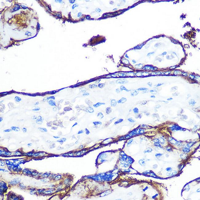 CD55 Antibody in Immunohistochemistry (Paraffin) (IHC (P))