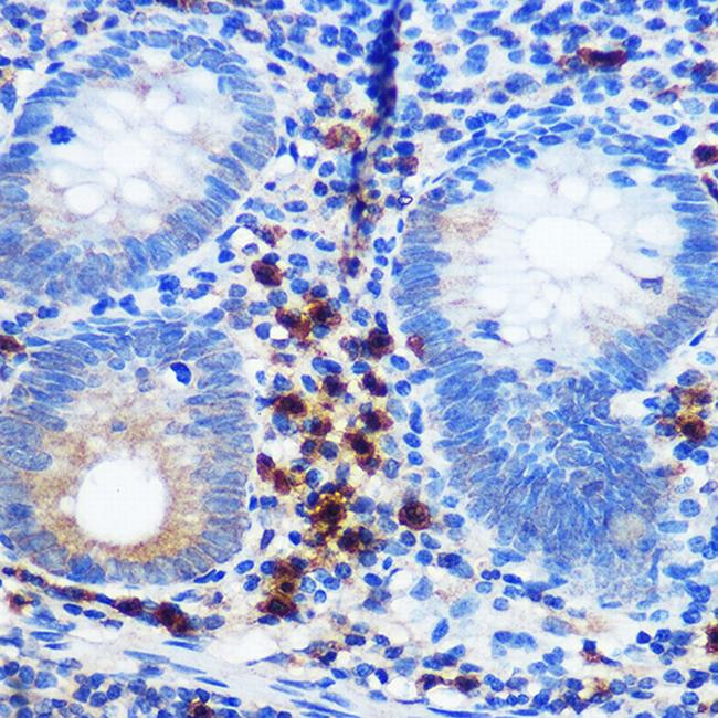 CD41 Antibody in Immunohistochemistry (Paraffin) (IHC (P))