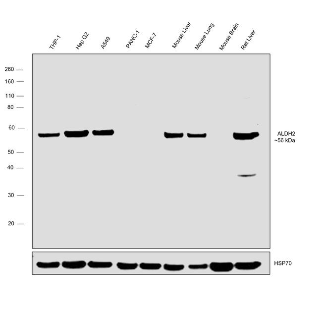 ALDH2 Antibody in Western Blot (WB)