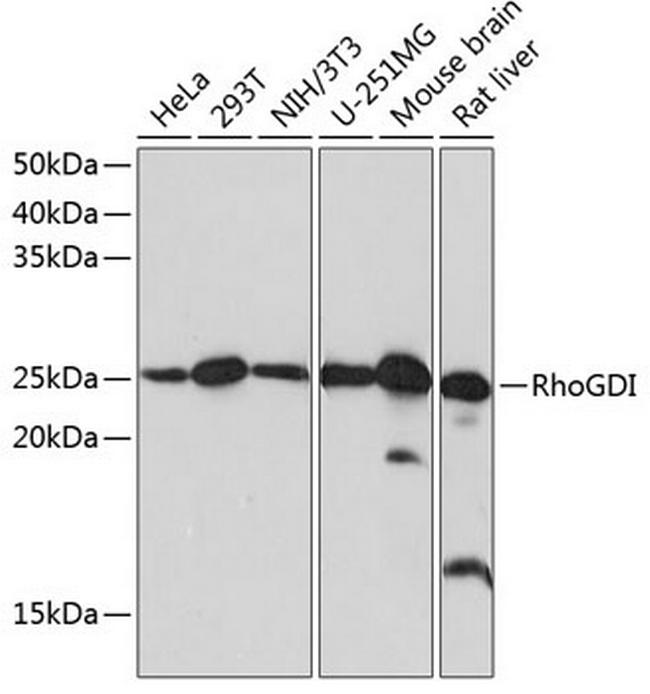 RhoGDI Antibody in Western Blot (WB)