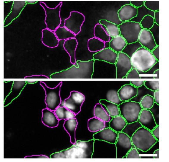 hnRNP A1 Antibody in Immunocytochemistry (ICC/IF)