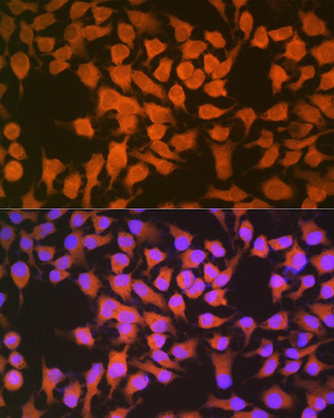 CBS Antibody in Immunocytochemistry (ICC/IF)