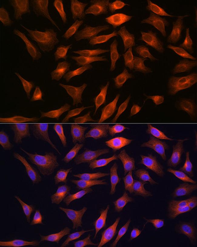 FBP1 Antibody in Immunocytochemistry (ICC/IF)