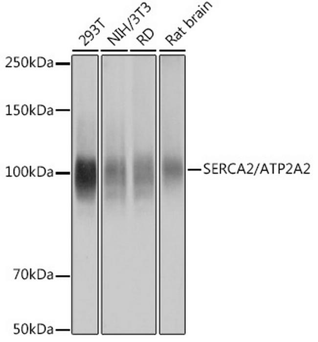 SERCA2 ATPase Antibody in Western Blot (WB)