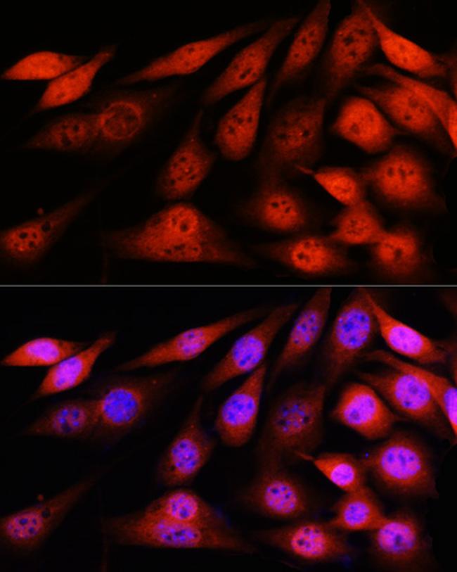 VCP Antibody in Immunocytochemistry (ICC/IF)