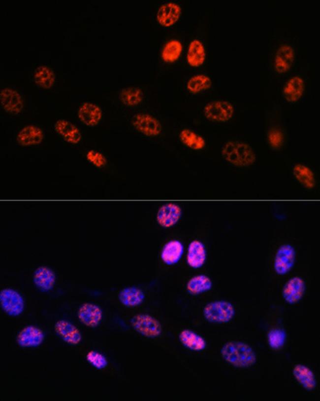 PABPN1 Antibody in Immunocytochemistry (ICC/IF)