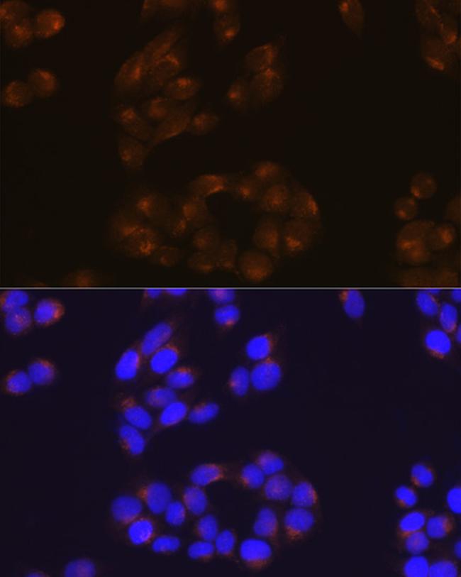 Amyloid Precursor Protein Antibody in Immunocytochemistry (ICC/IF)