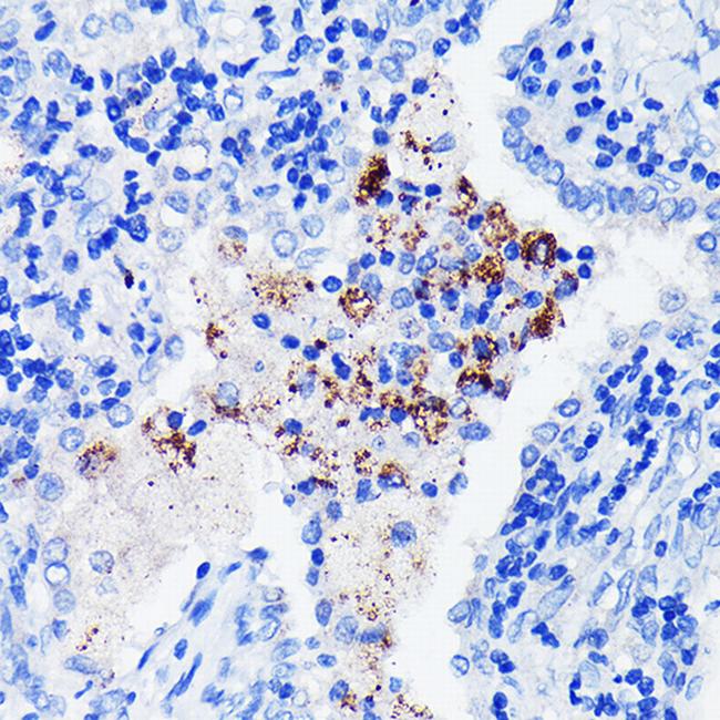 BTK Antibody in Immunohistochemistry (Paraffin) (IHC (P))