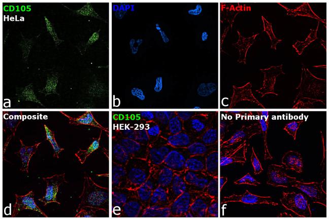 CD105 Antibody in Immunocytochemistry (ICC/IF)