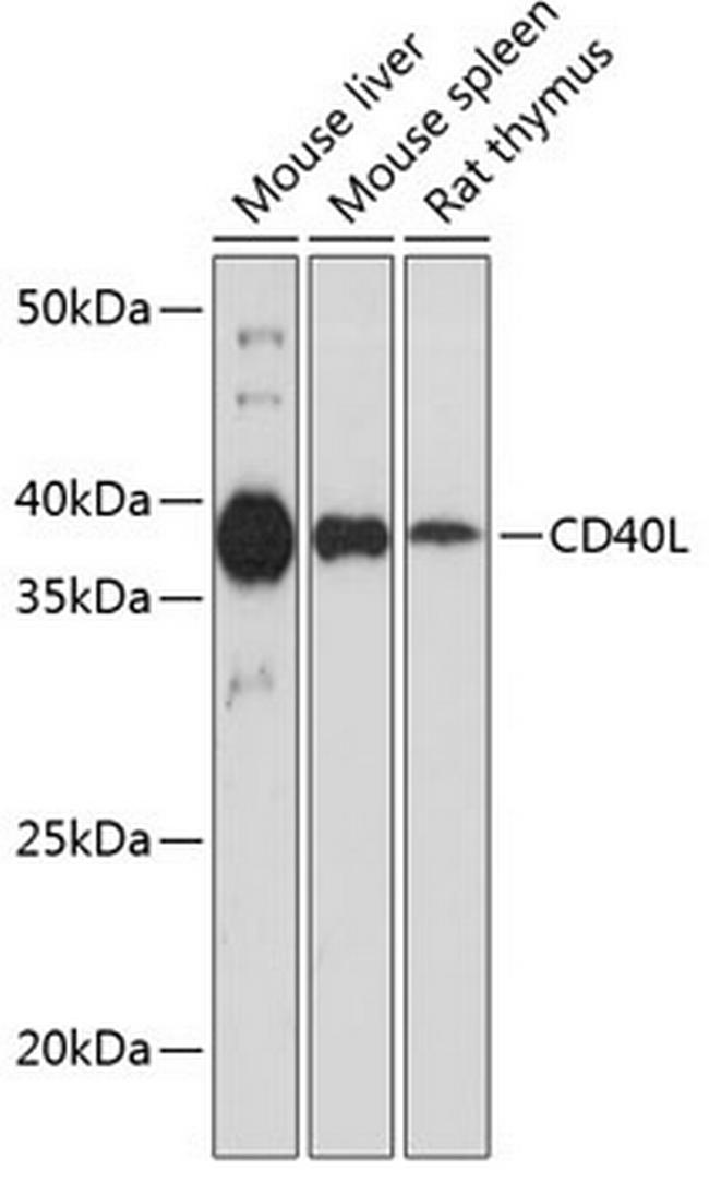 CD154 (CD40 Ligand) Antibody in Western Blot (WB)