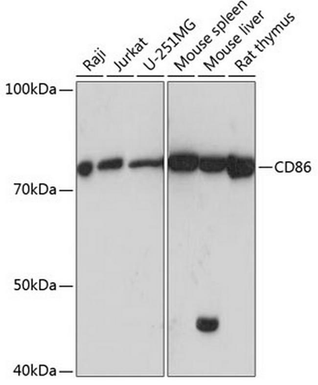 CD86 Antibody in Western Blot (WB)