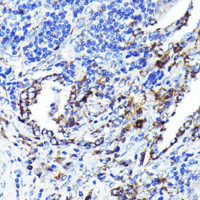 CD9 Antibody in Immunohistochemistry (Paraffin) (IHC (P))