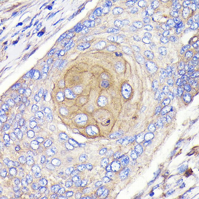 FGFR3 Antibody in Immunohistochemistry (Paraffin) (IHC (P))