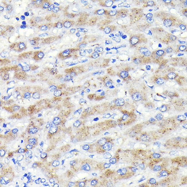 GBA Antibody in Immunohistochemistry (Paraffin) (IHC (P))