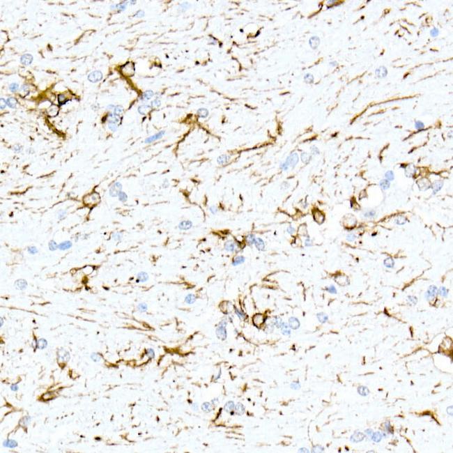 GFAP Antibody in Immunohistochemistry (Paraffin) (IHC (P))