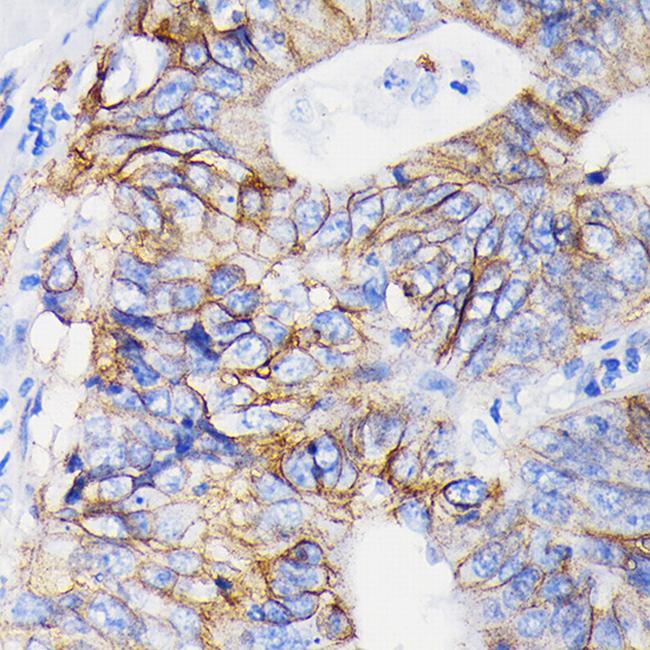 ITGA2 Antibody in Immunohistochemistry (Paraffin) (IHC (P))