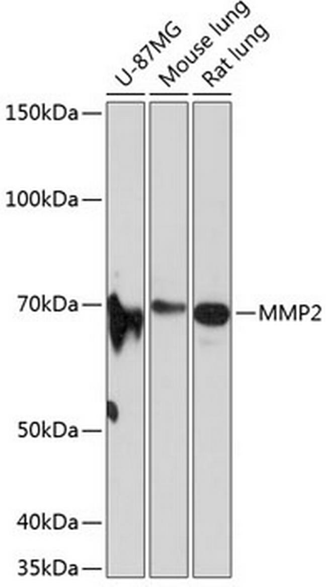 MMP2 Antibody in Western Blot (WB)