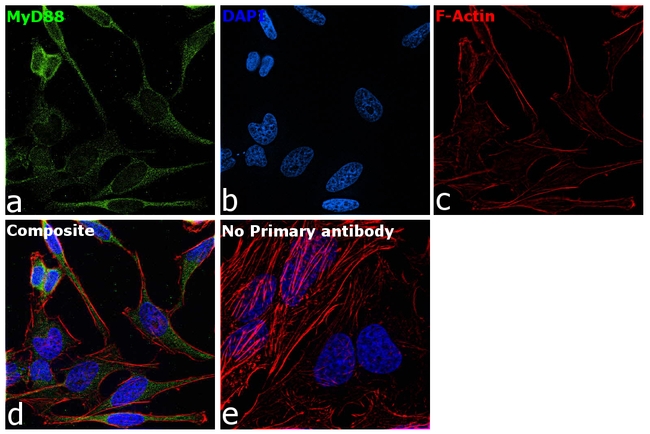 MyD88 Antibody in Immunocytochemistry (ICC/IF)