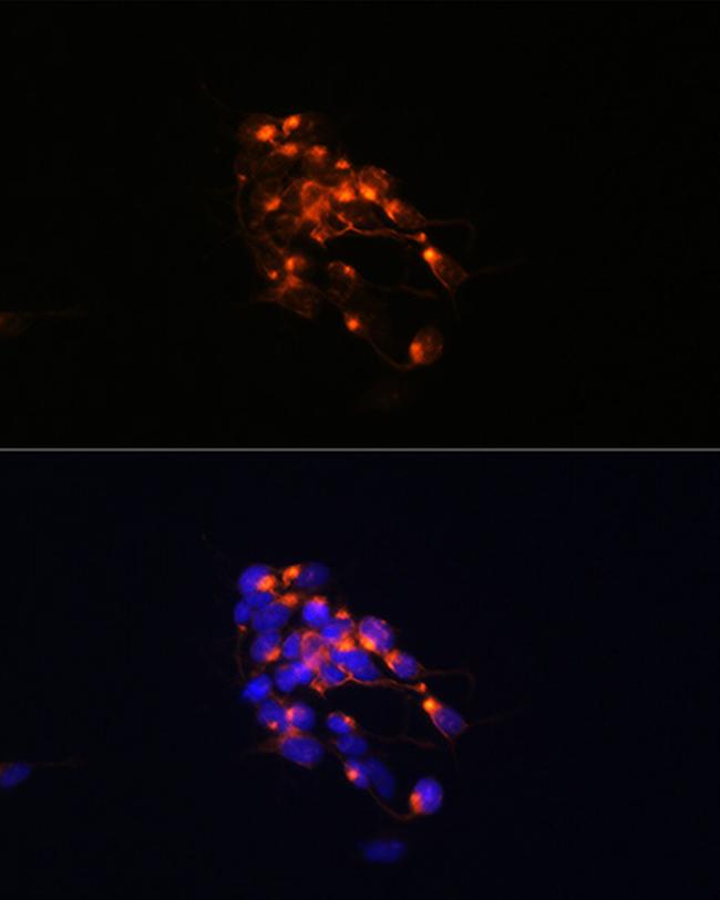 NEFM Antibody in Immunocytochemistry (ICC/IF)