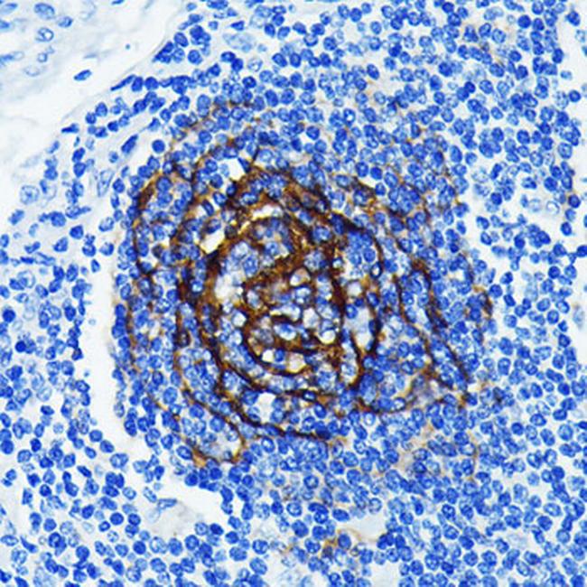 NGFR Antibody in Immunohistochemistry (Paraffin) (IHC (P))