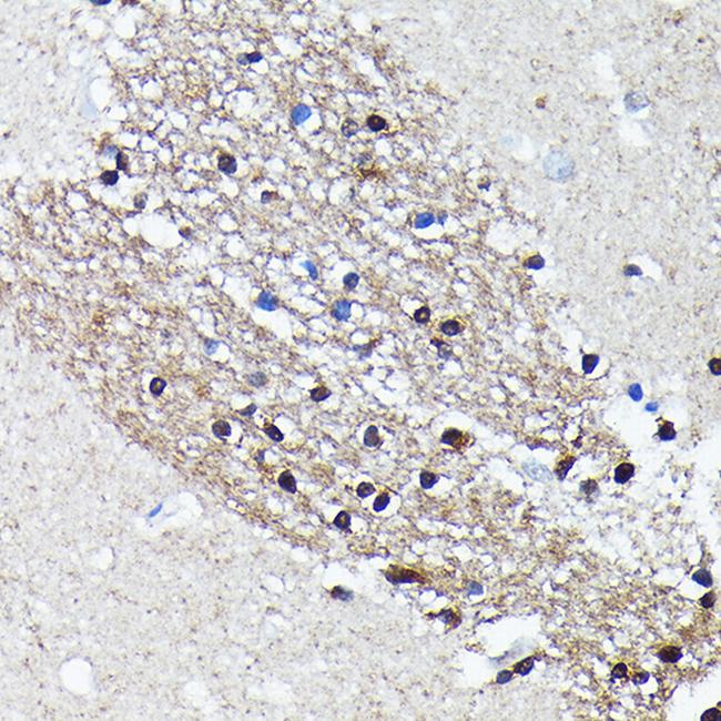 NMDAR2A Antibody in Immunohistochemistry (Paraffin) (IHC (P))