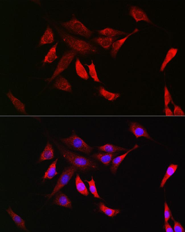 SHP2 Antibody in Immunocytochemistry (ICC/IF)