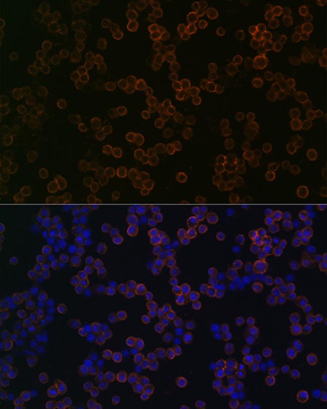 TLR2 Antibody in Immunocytochemistry (ICC/IF)