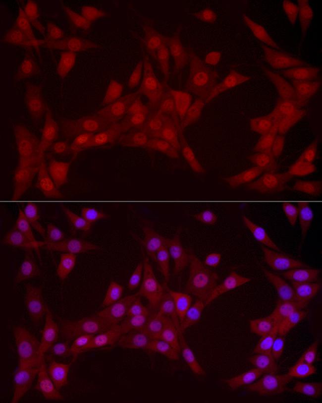 YAP1 Antibody in Immunocytochemistry (ICC/IF)