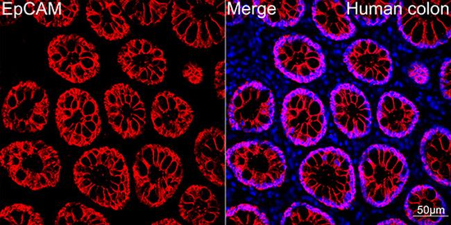 EpCAM Antibody in Immunohistochemistry (Paraffin) (IHC (P))