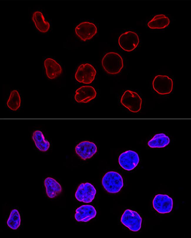 Lamin A/C Antibody in Immunocytochemistry (ICC/IF)