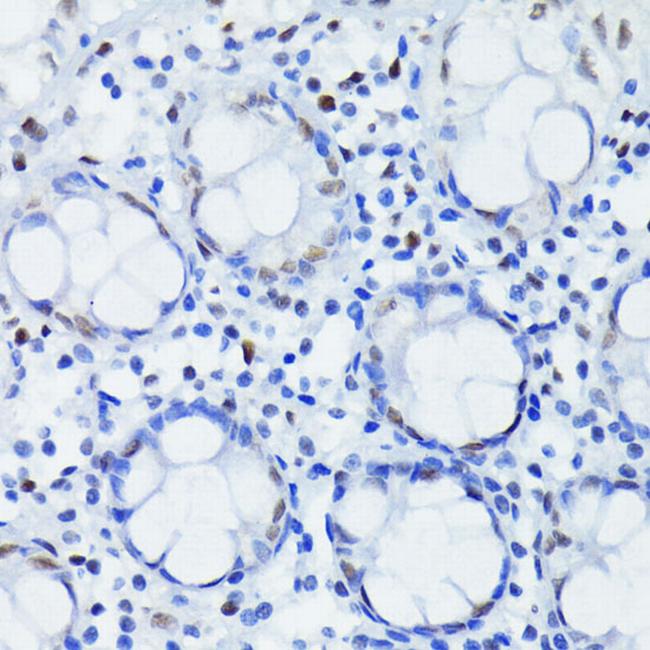 HIF-1 beta Antibody in Immunohistochemistry (Paraffin) (IHC (P))