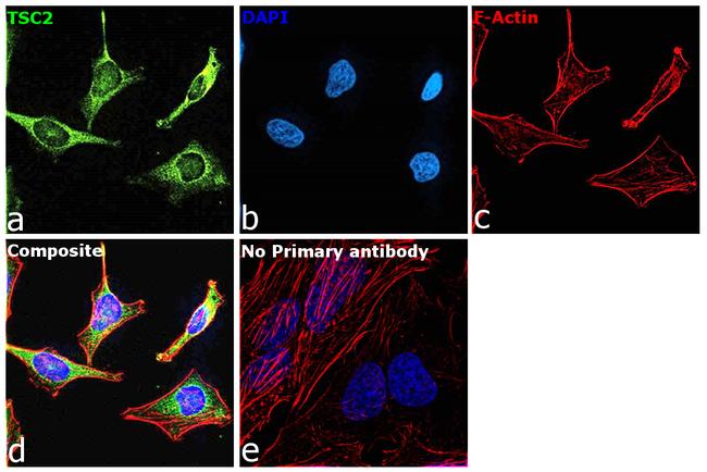 TSC2 Antibody in Immunocytochemistry (ICC/IF)