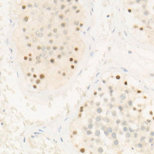 CHK2 Antibody in Immunohistochemistry (Paraffin) (IHC (P))