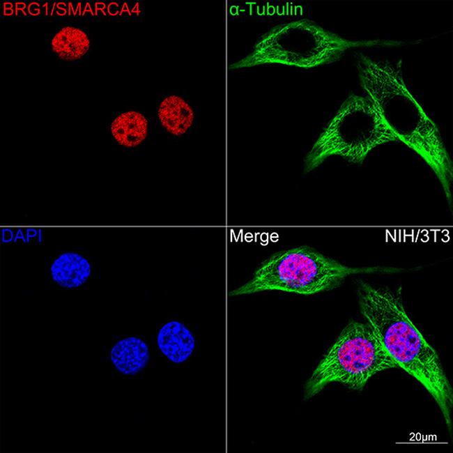 BRG1 Antibody in Immunocytochemistry (ICC/IF)