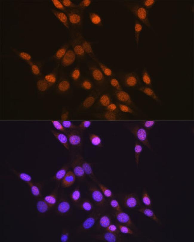 CTCF Antibody in Immunocytochemistry (ICC/IF)