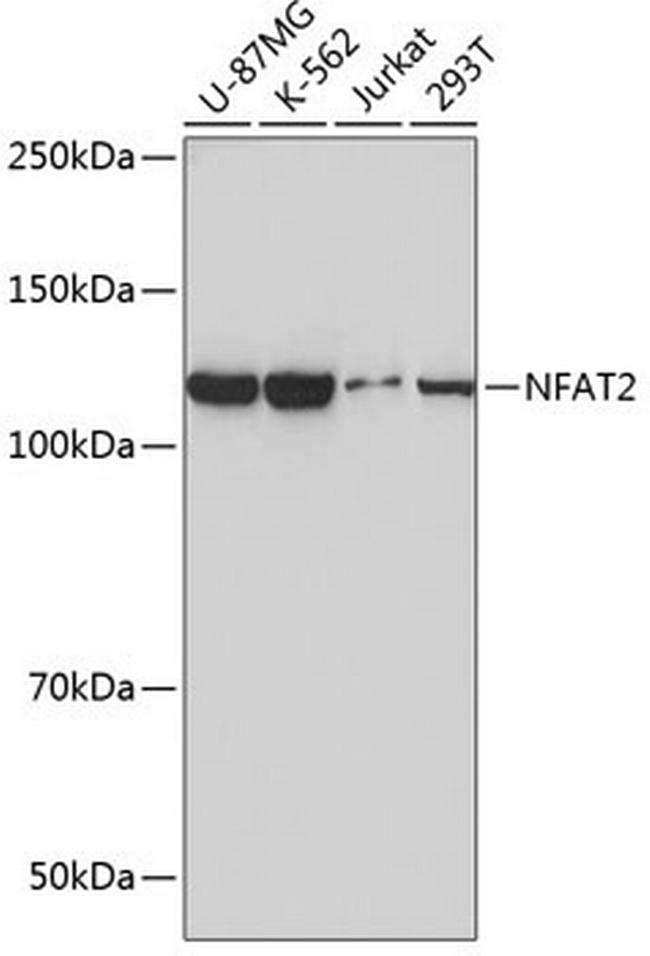 NFATC1 Antibody in Western Blot (WB)