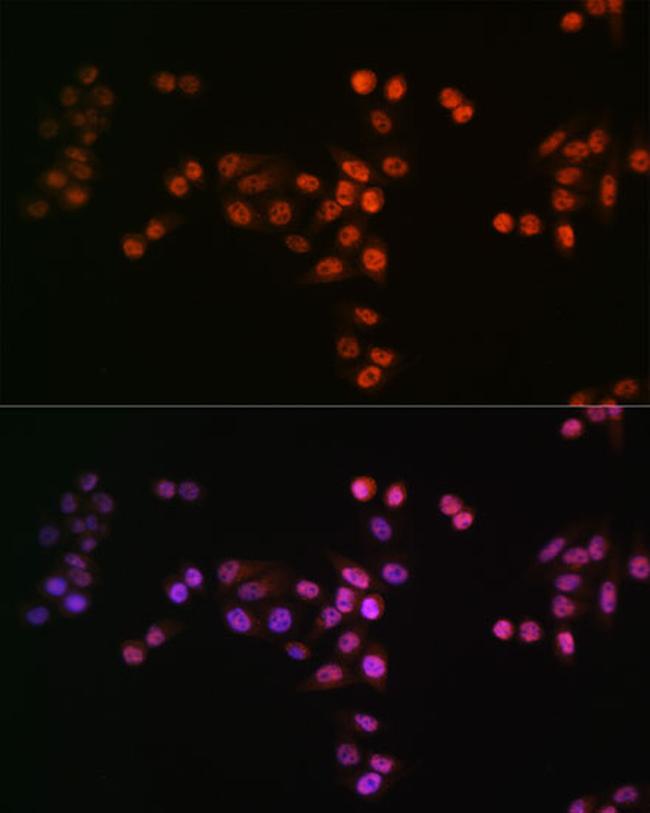 Drosha Antibody in Immunocytochemistry (ICC/IF)