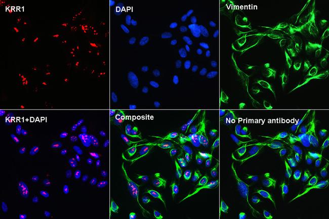 Vimentin Antibody in Immunocytochemistry (ICC/IF)