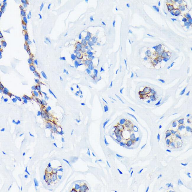 H-Ras Antibody in Immunohistochemistry (Paraffin) (IHC (P))