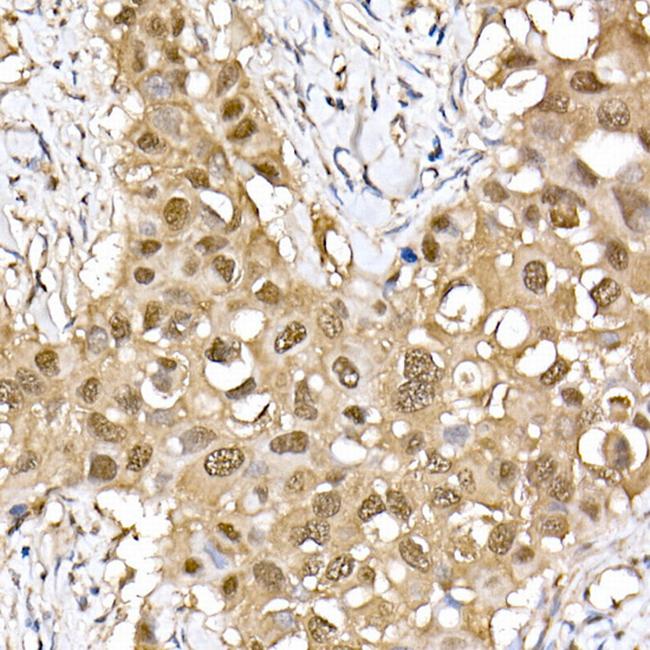 ERK2 Antibody in Immunohistochemistry (Paraffin) (IHC (P))