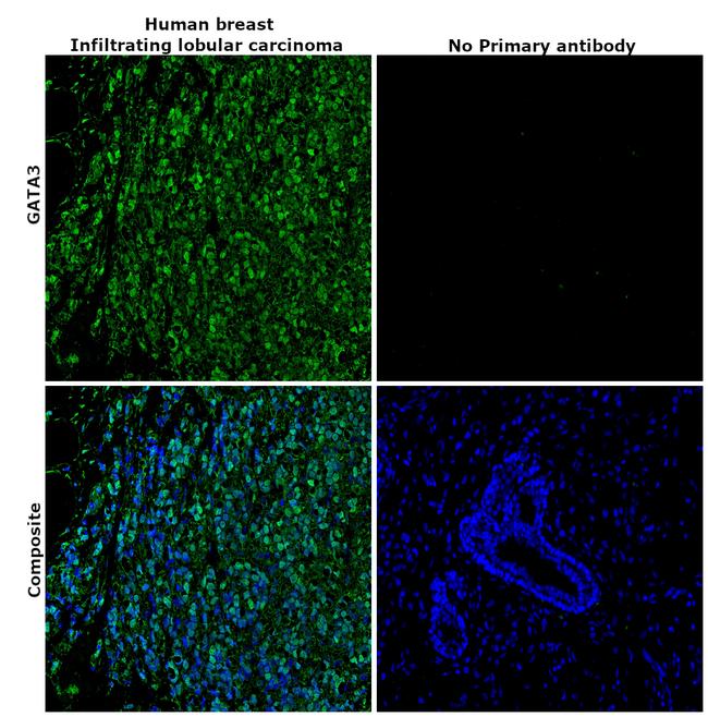 GATA3 Antibody in Immunohistochemistry (Paraffin) (IHC (P))