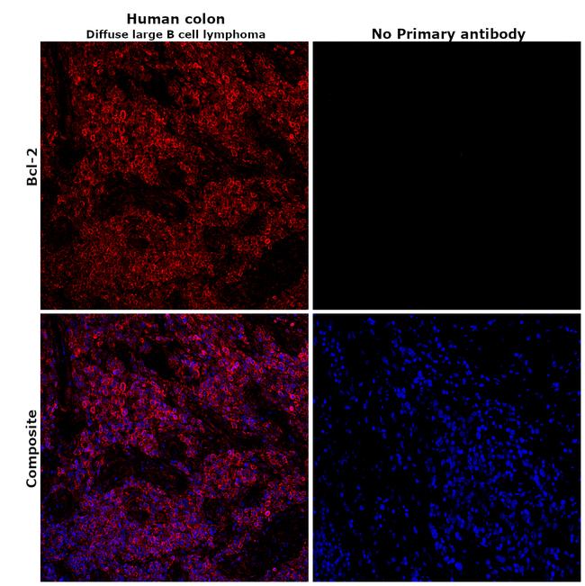 BCL-2 Antibody in Immunohistochemistry (Paraffin) (IHC (P))