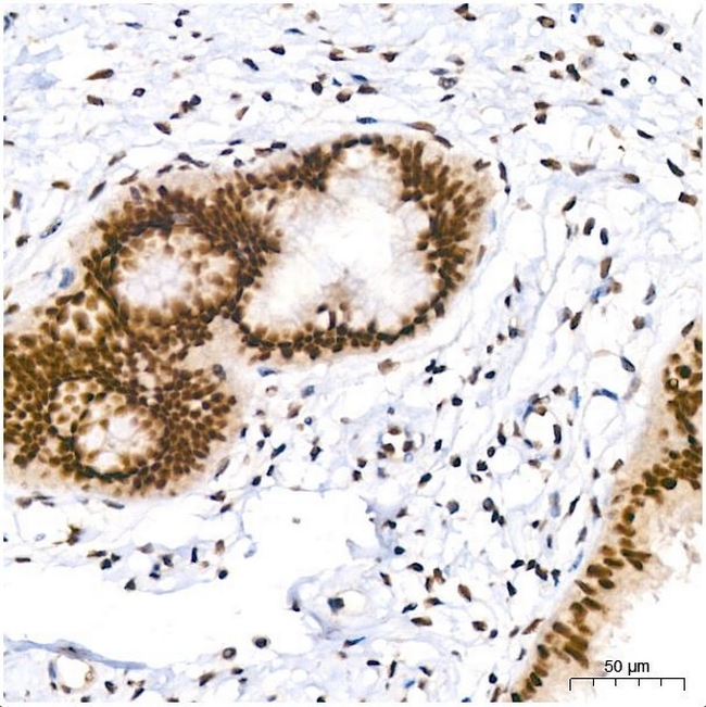 PIM1 Antibody in Immunohistochemistry (Paraffin) (IHC (P))