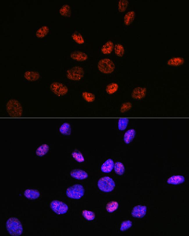 HDAC9 Antibody in Immunocytochemistry (ICC/IF)