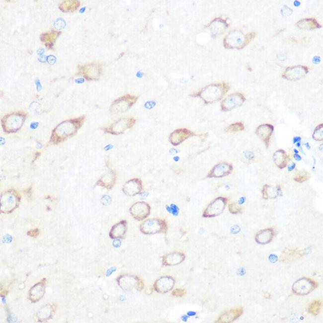 TPT1 Antibody in Immunohistochemistry (Paraffin) (IHC (P))