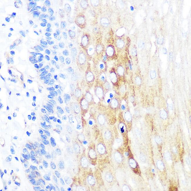 ROCK2 Antibody in Immunohistochemistry (Paraffin) (IHC (P))