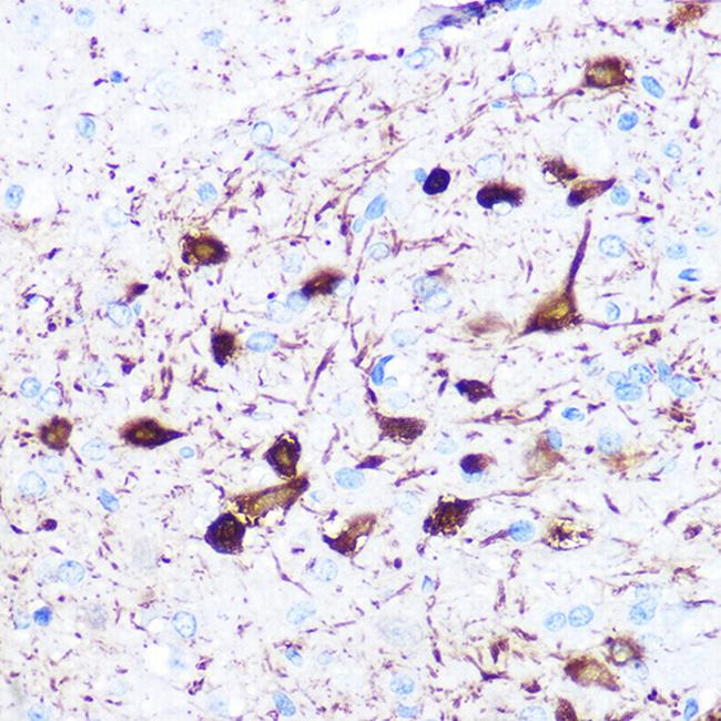 gamma Synuclein Antibody in Immunohistochemistry (Paraffin) (IHC (P))