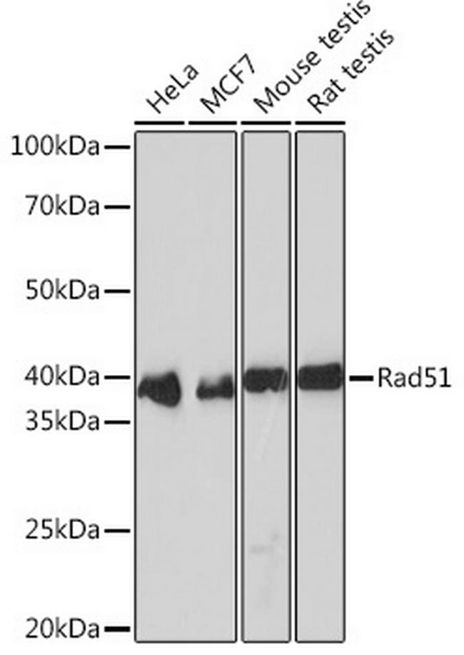 RAD51 Antibody in Western Blot (WB)