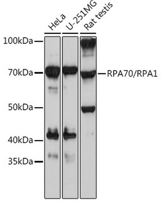 RPA70 Antibody in Western Blot (WB)