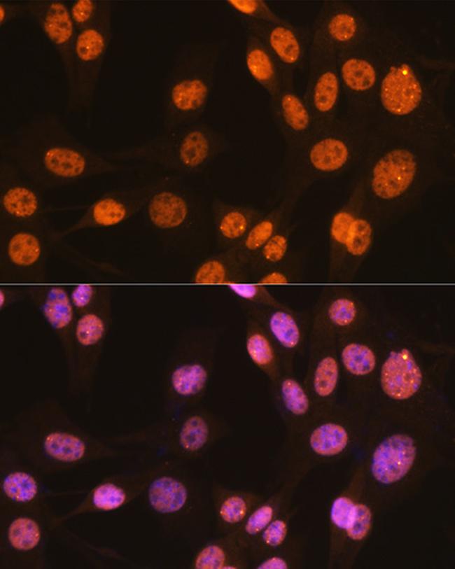 PTBP1 Antibody in Immunocytochemistry (ICC/IF)